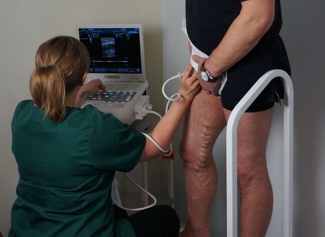 εξέταση φλεβών πριν την πήξη με λέιζερ για κιρσούς